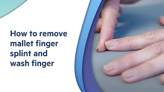 How to remove mallet finger splint and wash finger  explained by an Orthopaedic Surgeon [upl. by Akehsay]