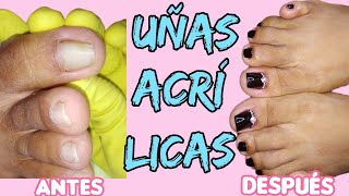 🥰Como Poner Uñas Acrílicas en los Pies Paso a Paso Embelle Ser💯 [upl. by Irakuy968]