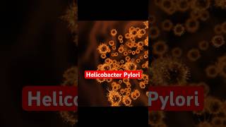 Do You Have Helicobacter Pylori  Symptoms Of Hpylori gastritis helicobacterpylori shorts [upl. by Tersina644]