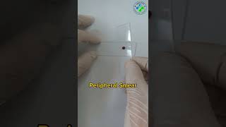 Making a peripheral blood smear  blood smear preparation  prepare a perfect blood smearHematology [upl. by Idonah761]