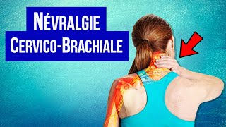 Névralgie cervicobrachiale  Symptôme et Traitement [upl. by Floridia39]