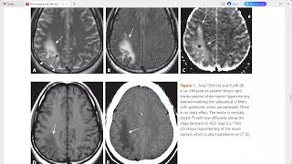 BRAIN IMAGING WITH MRI AND CT [upl. by Jauch]