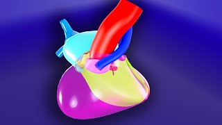 Tetralogy of Fallot  3D Animated Visual Lecture [upl. by Vil679]