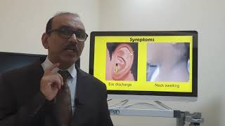 Citellis Abscess English Patient teaching programme [upl. by Levina]