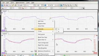 PicoScope 6 Viewing Waveforms [upl. by Gessner]