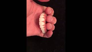 Upper Solid Zirconia Hybrid Implant Denture [upl. by Mehalick]