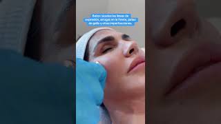 Botox ara eliminar las areugas [upl. by Adnanref]