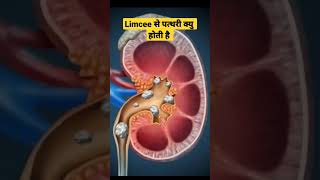 Limcee Tablet Side Effects in Hindi limcee shorts limceetablet [upl. by Enelie895]