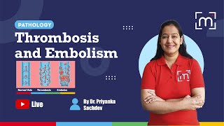 Thrombosis and Embolism with Dr Priyanka Sachdev [upl. by Dillie]