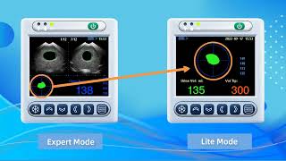 Bladder scanner BVT02 Introduction [upl. by Atteuqahc263]