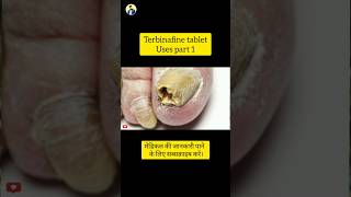 Terbinafine tablet Uses part 1 [upl. by Onairda]