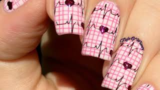 Beaus Lines in Nails Unveiling Clues to a Patients Medical History [upl. by Taffy]