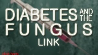 Diabetes  Know The Cause  With Doug Kaufmann [upl. by Nylssej]