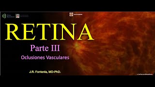 Retina Parte III Oclusiones Vasculares [upl. by Chesnut572]