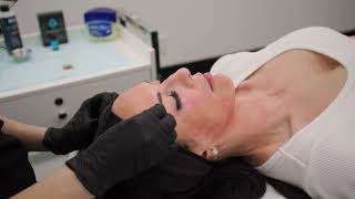 Perfect Derma Peel with Rayna No Dialogue [upl. by Landre311]