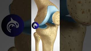 Understanding ACL Injuries Causes Prevention and Treatment [upl. by Mosira]