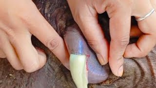 Dressing of abscess drained wound followup drpradipbhandari [upl. by Aneroc561]