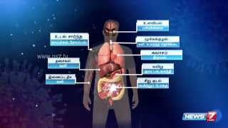 What are the symptoms of swine flu H1N1  News7 Tamil [upl. by Karleen663]