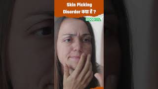 What is Skin Picking Disorder Skin Picking Disorder kya h How to stop skin picking on Face [upl. by Specht210]