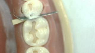 Cl II Cavity preparation Lower 2nd Premolar GV Black Dr Ahmed Sleibi [upl. by Ahsitam]