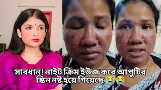 নাইট ক্রিমের ভয়াবহ ইফেক্টে মুখের ১২ টা বেজে গেল side effect of night cream  khadija begum [upl. by Agosto433]