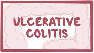 What are Crohns and Colitis [upl. by Andriana877]