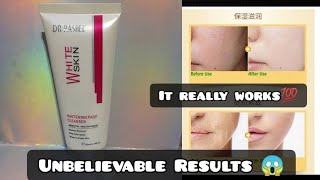 Review of Dr rashel whitening cleanser Makeup remover Heals skin best for acne and scars [upl. by Acus969]