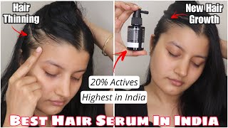 BEST HAIR GROWTH SERUM IN INDIA With Highest  of Actives [upl. by Bachman]