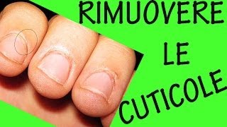 COME RIMUOVERE LE CUTICOLE Sos unghie 9 [upl. by Zinah]