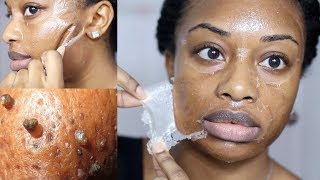 DIY Milk Blackhead Remover Peel Off Mask [upl. by Tallbot973]