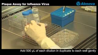 Plaque Assay for Influenza Virus [upl. by Callie]