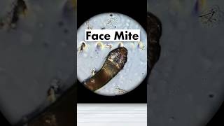 Face mite is it dangerous science biology microscope worms facemite serratia [upl. by Spike]