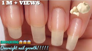 How to Grow Your Nails FASTER and LONGER using GARLIC😱 Basic Nail Art Tutorial [upl. by Aieki]