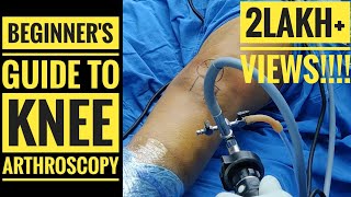 Beginners Guide to Knee Arthroscopy [upl. by Clive367]