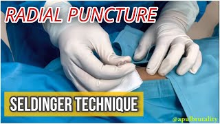 Radial puncture with Seldinger technique  tutorial  coronary angiography [upl. by Annoyik]