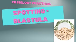 Spotting TS Blastula XII Biology Practical [upl. by Ameehsat]