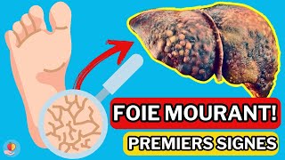 LE FOIE est en train de MOURIR 15 Signes étranges de DOMMAGES AU FOIE [upl. by Oconnor]