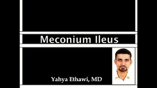 Meconium Ileus [upl. by Lynnett284]