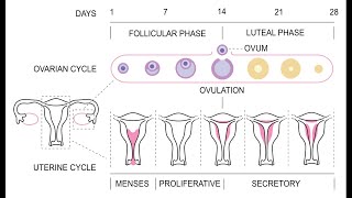 Amenorrhea  Definition Causes Signs and Symptoms Investigation and Management [upl. by Ratep386]