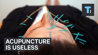 Acupuncture is useless [upl. by Calista415]