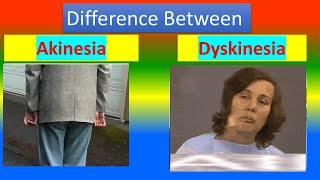 Difference between Akinesia and Dyskinesia [upl. by Oakes716]