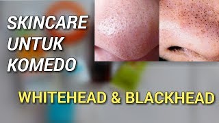 SKINCARE UNTUK MENGHILANGKAN KOMEDO WHITEHEAD amp BLACKHEAD  Novie Marru [upl. by Ecnahc296]