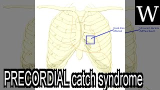 PRECORDIAL catch syndrome  WikiVidi Documentary [upl. by Aiset801]