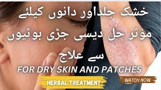 خشک جلداور دانوں کیلئے مؤثر حل دیسی جڑی بوٹیوں سے علاجFor Dry Skin Care and patches [upl. by Navetse471]