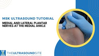 MSK ultrasound evaluation of the medial and lateral plantar nerves [upl. by Brose]