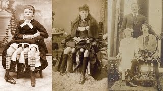 IN MEMORY OF MYRTLE CORBIN THE 4 LEGGED WOMAN [upl. by Moynahan]