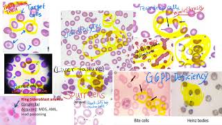 hematology in 10 min Peripheral blood smear examination under microscope [upl. by Anak]