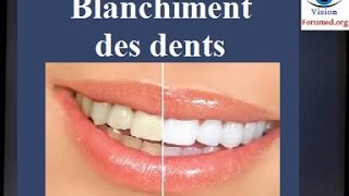 Blanchiment des dents techniques [upl. by Atims]