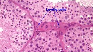 MAXIMIZE YOUR TESTOSTERONE  Leydig Cells [upl. by Salta]