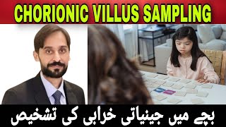 Chorionic Villus Sampling [upl. by Iturhs]